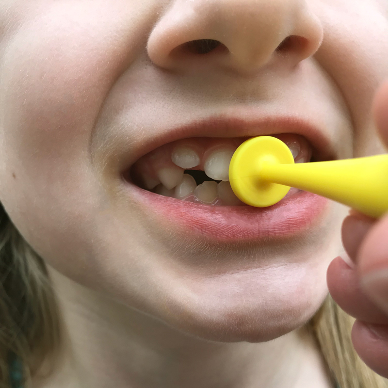 Button Pull Lip Closure Activity First step of oral motor exercise: Mouth closeup with button held in front of the teeth before the lips have closed around it