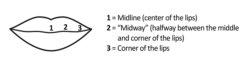 Button Pull Lip Closure Activity Illustration labeling the midline (center) of the lips, corner of the lines, and midway between