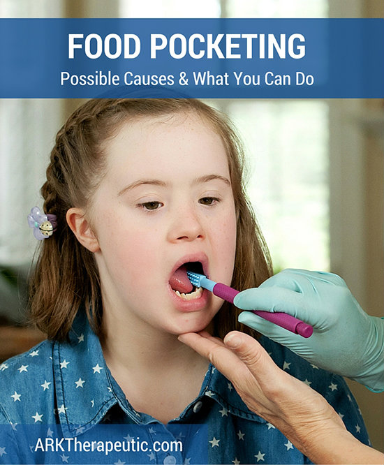 Food Pocketing in the Lips, Cheeks, and/or Gums