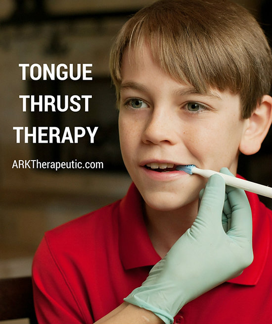 Tongue Thrust Therapy