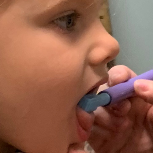 5 Ways to Easily Assess Tongue-Ties Using ONE Simple Tool A therapist uses the Z-Vibe on a patient to look for any restrictions as a sign of tongue tie